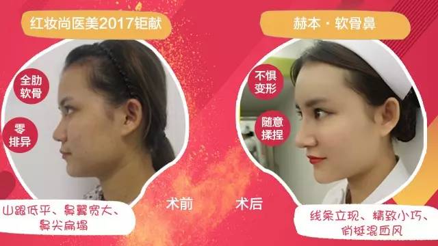 热烈祝贺首季招募完美收官暨赫本•软骨鼻体验官签约仪式圆满落幕！